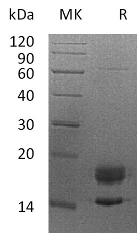 Recombinant Human MPZ (C-6His)