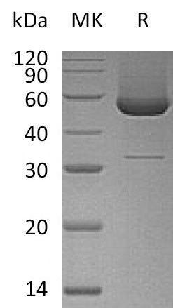 Recombinant Human Serpin H1 (C-6His)
