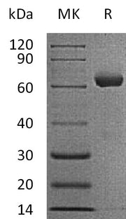 Recombinant Human IGSF11 (C-Fc)