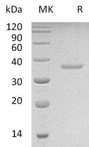Recombinant Human PRPS2 (C-6His)