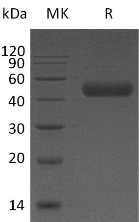 Recombinant Human Galectin 9 (C-6His)