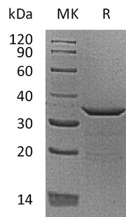 Recombinant Human PDYN (C-6His)
