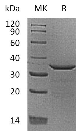 Recombinant Human PDYN (C-6His)