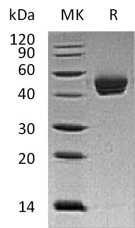 Recombinant Human DPEP1 (C-6His)
