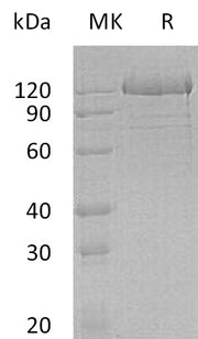 Recombinant Human PCDH1 (C-6His)