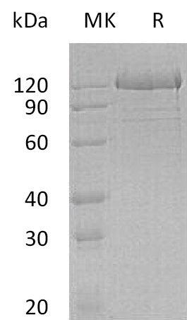 Recombinant Human PCDH1 (C-6His)