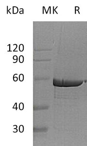 Recombinant Human G6PD (C-6His)