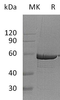 Recombinant Human G6PD (C-6His)
