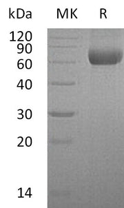 Recombinant Human HATL5 (C-6His)