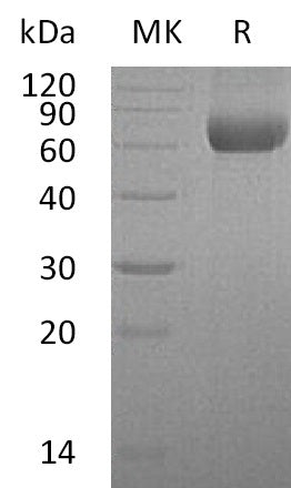 Recombinant Human HATL5 (C-6His)