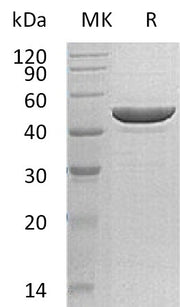 Recombinant Human RRM2 (C-6His)