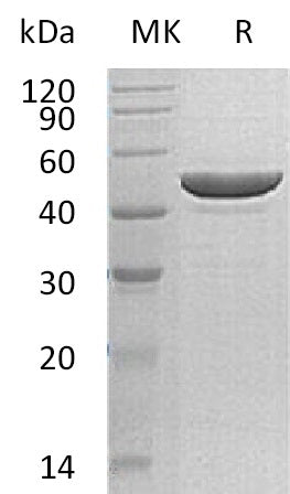 Recombinant Human RRM2 (C-6His)