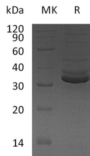 Recombinant Human GPD1 (C-6His)