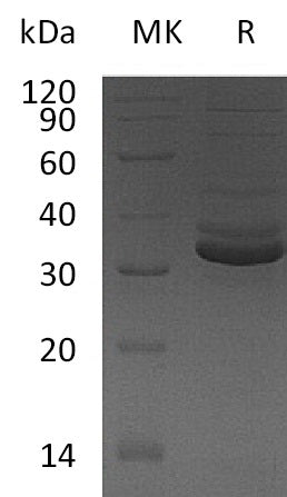 Recombinant Human GPD1 (C-6His)