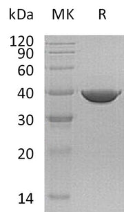 Recombinant Human TALDO1 (C-6His)