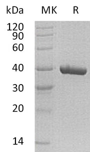 Recombinant Human Carbonic Anhydrase 11 (C-6His)