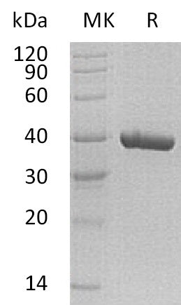 Recombinant Human Carbonic Anhydrase 11 (C-6His)