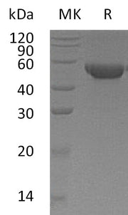 Recombinant Human MGAT2 (C-6His)