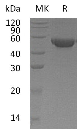 Recombinant Human MGAT2 (C-6His)