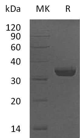 Recombinant Human VIP36 (C-6His)