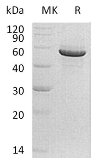 Recombinant Human PACSIN1 (C-6His)
