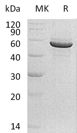 Recombinant Human PACSIN1 (C-6His)