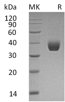 Recombinant Human PPT1 (C-6His)
