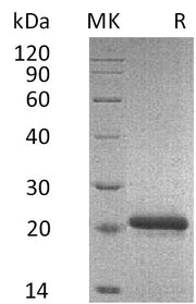 Recombinant Mouse TIMP-2 (C-6His)