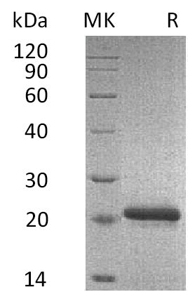 Recombinant Mouse TIMP-2 (C-6His)