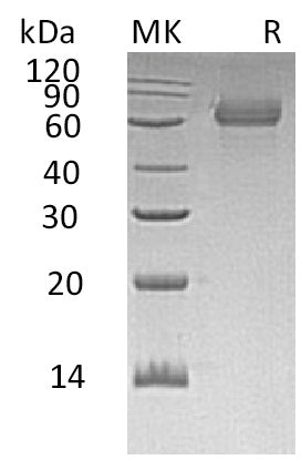 Recombinant Human TGOLN2 (C-6His)