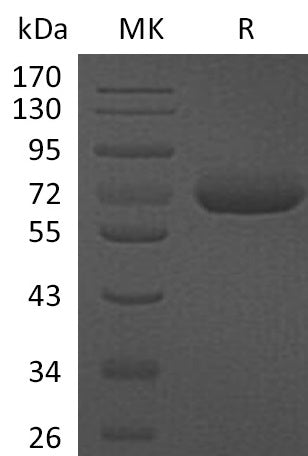 Recombinant Human CFHR5 (C-6His)