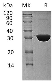 Recombinant Human KHK (C-6His)