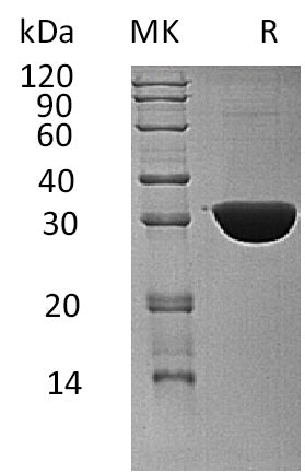 Recombinant Human KHK (C-6His)