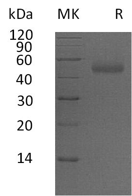 Recombinant Human PSG5 (C-6His)
