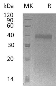 Recombinant Mouse IGFBP-5 (C-6His)