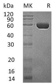 Recombinant Human CPVL (C-6His)