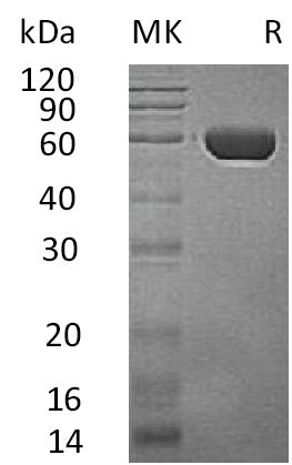 Recombinant Human CPVL (C-6His)