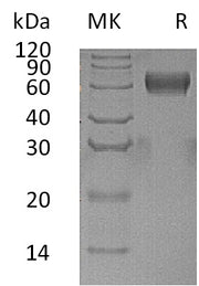 Recombinant Human PSG1 (C-6His)