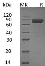 Recombinant Human IL-10RB (C-Fc)