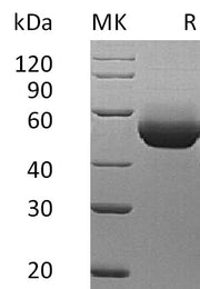 Recombinant Mouse IL-5RA (C-6His)