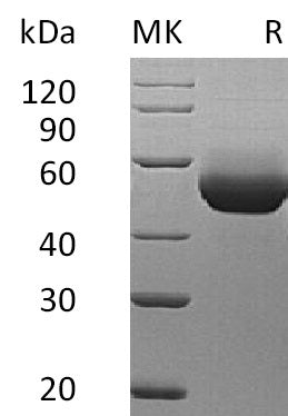Recombinant Mouse IL-5RA (C-6His)