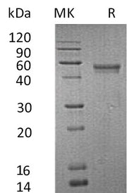 Recombinant Human XCL1 (C-Fc-6His)