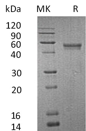 Recombinant Human XCL1 (C-Fc-6His)