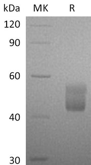 Recombinant Human CFHR3 (C-6His)