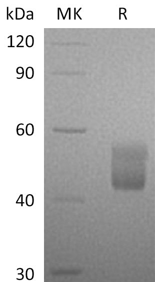 Recombinant Human CFHR3 (C-6His)