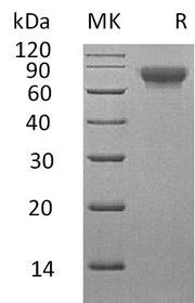 Recombinant Human SLAMF3 (C-6His)