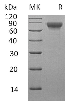 Recombinant Human SLAMF3 (C-6His)