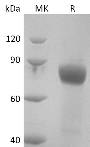 Recombinant Human IL-18RAcP (C-Fc-6His)