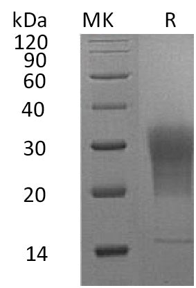 Recombinant Mouse LAIR1 (C-6His)