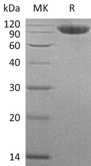 Recombinant Human CFHR4 (C-6His)